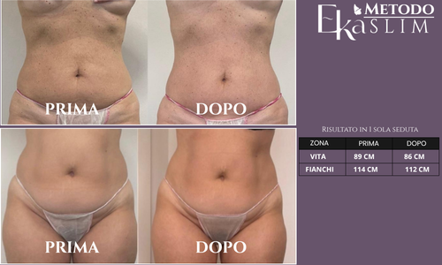 modellamento corpo